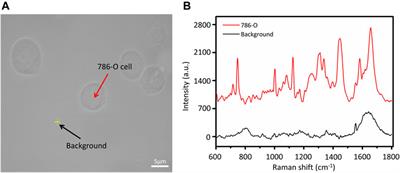 Detection and Classification of Multi-Type Cells by Using Confocal Raman Spectroscopy